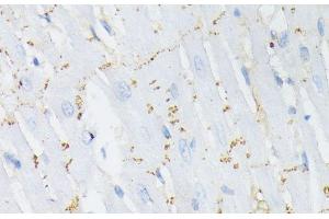 Immunohistochemistry of paraffin-embedded Rat heart using Phospho-GJA1(S368) Polyclonal Antibody at dilution of 1:200 (40x lens). (Connexin 43/GJA1 Antikörper  (pSer368))