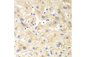 Immunohistochemistry of paraffin-embedded human liver injury using DNM1L antibody. (Dynamin 1-Like Antikörper)