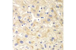 Immunohistochemistry of paraffin-embedded human liver injury using DNM1L antibody.