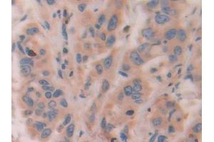 Immunohistochemistry (IHC) image for anti-Activating Transcription Factor 4 (Tax-Responsive Enhancer Element B67) (ATF4) (AA 130-347) antibody (ABIN7433582)