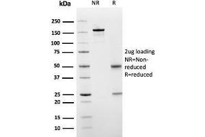 SDS-PAGE Analysis Purified PAI-RBP1 Mouse Monoclonal Antibody (SERBP1/3498). (SERBP1 Antikörper  (AA 3-139))
