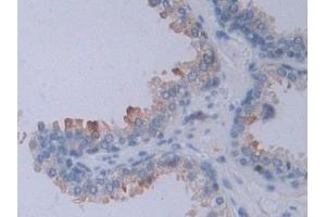 IHC-P analysis of Human Prostate Tissue, with DAB staining. (NRP2 Antikörper  (AA 231-490))
