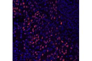 Immunofluorescence (IF) image for anti-General Transcription Factor III (GTF2I) (C-Term) antibody (ABIN7448970) (GTF2I Antikörper  (C-Term))