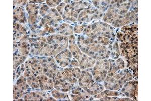 Immunohistochemical staining of paraffin-embedded Kidney tissue using anti-LIPG mouse monoclonal antibody. (LIPG Antikörper)