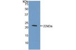Detection of Recombinant MPL, Human using Polyclonal Antibody to Thrombopoietin Receptor (TPOR) (MPL Antikörper  (AA 311-460))