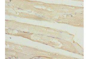 Immunohistochemistry of paraffin-embedded human skeletal muscle tissue using ABIN7159481 at dilution of 1:100 (TIMP1 Antikörper  (AA 24-207))