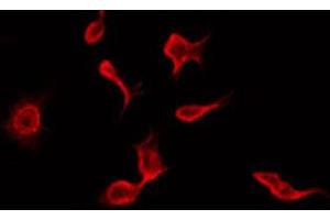 ABIN6272297 staining HepG2 by IF/ICC. (RIMKLB Antikörper  (Internal Region))