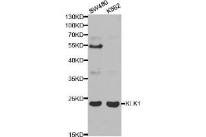 Western blot analysis of extracts of various cell lines, using KLK1 antibody (ABIN5970914) at 1/1000 dilution. (Kallikrein 1 Antikörper)