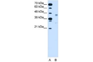 GPR161 antibody used at 2 ug/ml to detect target protein. (GPR161 Antikörper  (Middle Region))