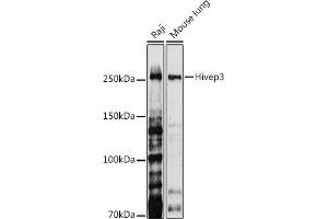 Western blot analysis of extracts of various cell lines, using Hivep3 antibody (ABIN7267792) at 1:1000 dilution. (Human Immunodeficiency Virus Type I Enhancer Binding Protein 3 (HIVEP3) Antikörper)