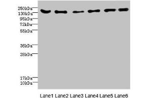 Western blot All lanes: CD1C antibody at 4. (ADGRG6 (AA 40-300) Antikörper)