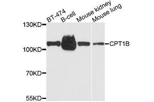 Western blot analysis of extracts of various cell lines, using CPT1B antibody. (CPT1B Antikörper  (AA 533-772))