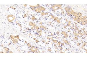 Detection of FASL in Human Stomach Tissue using Polyclonal Antibody to Factor Related Apoptosis Ligand (FASL) (FASL Antikörper  (AA 103-281))