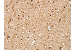 The image on the left is immunohistochemistry of paraffin-embedded Human brain tissue using ABIN7192648(SRP68 Antibody) at dilution 1/25, on the right is treated with synthetic peptide. (SRP68 Antikörper)