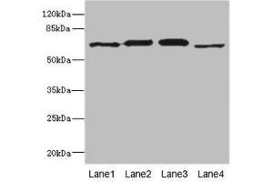 Western blot All lanes: RPN2 antibody at 1. (Ribophorin II Antikörper  (AA 360-540))