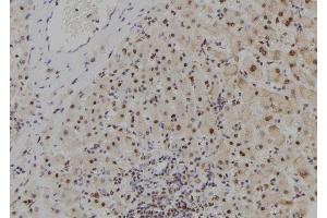 ABIN6278982 at 1/100 staining Human liver tissue by IHC-P. (MYCNOS Antikörper)