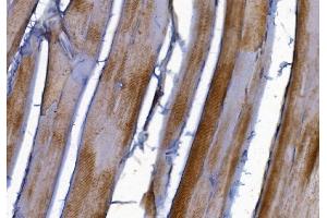 IHC analysis of PAK2 using anti-PAK2 antibody (ABIN7599219). (PAK2 Antikörper  (AA 1-288))