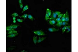 Immunofluorescence staining of Hela cells with ABIN7174472 at 1:66, counter-stained with DAPI. (UBE2N Antikörper  (AA 20-138))