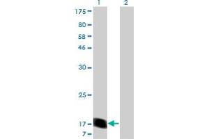 Western Blot analysis of RHEB expression in transfected 293T cell line by RHEB monoclonal antibody (M05), clone 1E12. (RHEB Antikörper  (AA 1-184))