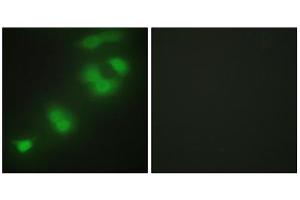 Immunofluorescence analysis of HepG2 cells, using CREBZF antibody. (CREBZF Antikörper  (C-Term))