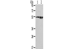Western Blot analysis of TM4 cell and Human placenta tissue using EAAT3 Polyclonal Antibody at dilution of 1/500 (SLC1A1 Antikörper)
