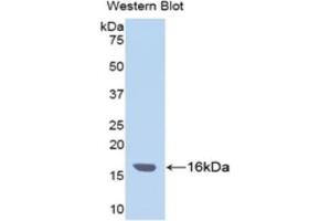 Detection of Recombinant ITIH4, Human using Polyclonal Antibody to Inter Alpha-Globulin Inhibitor H4 (ITIH4)