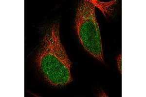 Immunofluorescent staining of human cell line U-2 OS with SRCAP polyclonal antibody  at 1-4 ug/mL dilution shows positivity in nucleus. (SRCAP Antikörper)