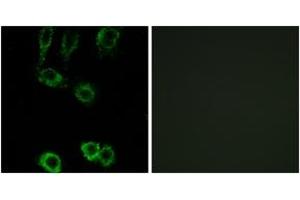 Immunofluorescence (IF) image for anti-Calponin 2 (CNN2) (AA 121-170) antibody (ABIN2890176) (CNN2 Antikörper  (AA 121-170))