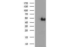 Image no. 2 for anti-LIM Homeobox 1 (LHX1) (AA 100-362) antibody (ABIN1490806)
