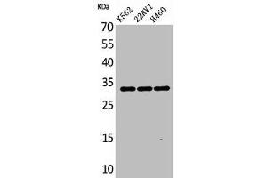 Western Blot analysis of K562 22RV-1 H460 cells using SCP-3 Polyclonal Antibody (SYCP3 Antikörper  (Internal Region))