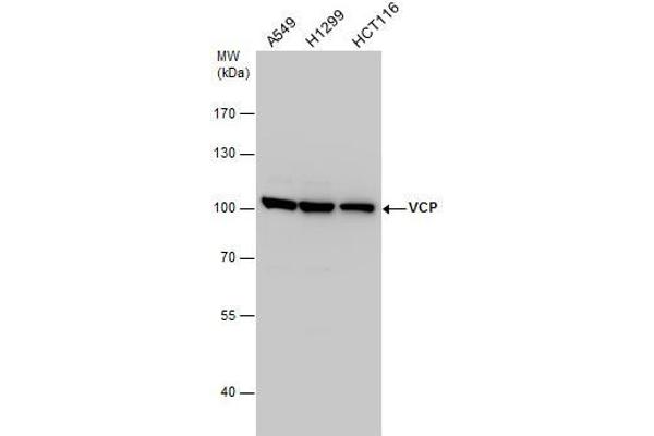 VCP Antikörper  (C-Term)