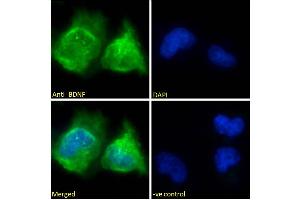 ABIN5539690 Immunofluorescence analysis of paraformaldehyde fixed U251 cells, permeabilized with 0.