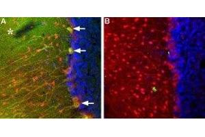 Expression of TRPC3 in rat cerebellumImmunohistochemical staining of TRPC3 in rat cerebellum using Anti-TRPC3 Antibody (ABIN7043820, ABIN7043966 and ABIN7043967).