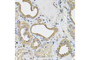 Immunohistochemistry of paraffin-embedded human kidney using ICOSL Antibody (ABIN6130065, ABIN6142131, ABIN6142132 and ABIN6222879) at dilution of 1:100 (40x lens). (ICOSLG Antikörper  (AA 19-256))