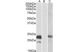 HEK293 lysate (10ug protein in RIPA buffer) overexpressing Human CST8 with C-terminal MYC tag probed with antibody (0. (CST8 Antikörper  (Internal Region))