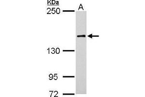 Western Blotting (WB) image for anti-rho-Associated, Coiled-Coil Containing Protein Kinase 1 (ROCK1) (N-Term) antibody (ABIN2856887)