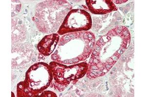Human Kidney: Formalin-Fixed, Paraffin-Embedded (FFPE). (NADPH Oxidase 4 Antikörper  (AA 220-392) (Biotin))