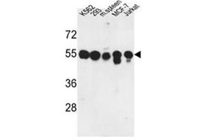 Western blot analysis of PPM1H Antibody in K562, 293, MCF-7, Jurkat cell line and mouse spleen tissue lysates (35ug/lane). (PPM1H Antikörper  (Middle Region))