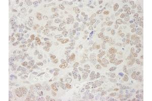 anti-Transcription Elongation Factor SPT5 (SUPT5H) (C-Term) antibody