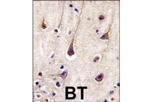 Formalin-fixed and paraffin-embedded human brain tissue reacted with PIK3R2-p, which was peroxidase-conjugated to the secondary antibody, followed by DAB staining.