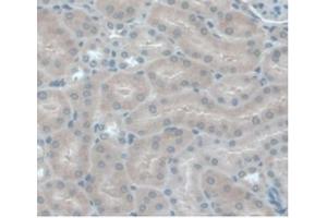 Detection of MCP1 in Mouse Kidney Tissue using Monoclonal Antibody to Monocyte Chemotactic Protein 1 (MCP1) (CCL2 Antikörper  (AA 24-96))