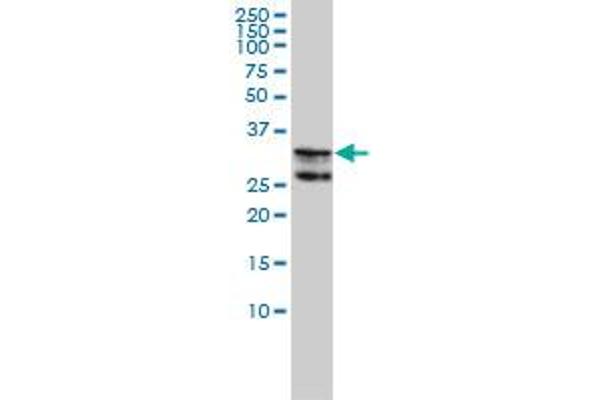 HNRNPA2B1 anticorps  (AA 1-249)