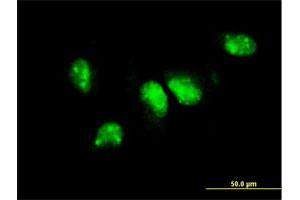 Immunofluorescence of monoclonal antibody to PIM1 on HeLa cell. (PIM1 Antikörper  (AA 1-100))