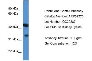 WB Suggested Anti-Centa1  Antibody Titration: 0. (ADAP1 Antikörper  (C-Term))