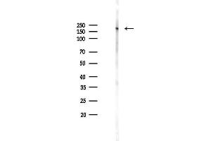 anti-Myosin Heavy Chain 11, Smooth Muscle (MYH11) (C-Term) antibody