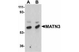 Image no. 1 for anti-Matrilin 3 (MATN3) (Internal Region) antibody (ABIN478078) (Matrilin 3 Antikörper  (Internal Region))