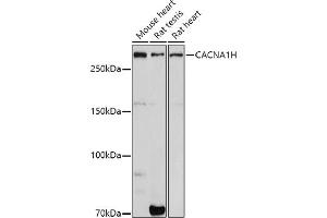 Western blot analysis of extracts of various cell lines, using CH antibody (ABIN7266015) at 1:1000 dilution.