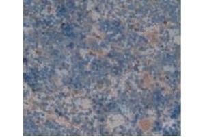 Detection of CFH in Rat Spleen Tissue using Polyclonal Antibody to Complement Factor H (CFH)