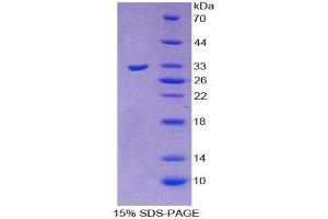 SDS-PAGE (SDS) image for Sorbitol Dehydrogenase (SORD) (AA 98-355) protein (His tag) (ABIN2126804) (SORD Protein (AA 98-355) (His tag))