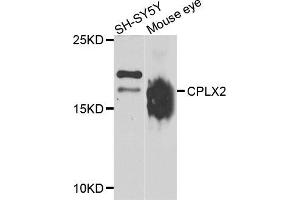 Western blot analysis of extracts of SH-SY5Y and mouse eye cell lines, using CPLX2 antibody. (CPLX2 Antikörper)